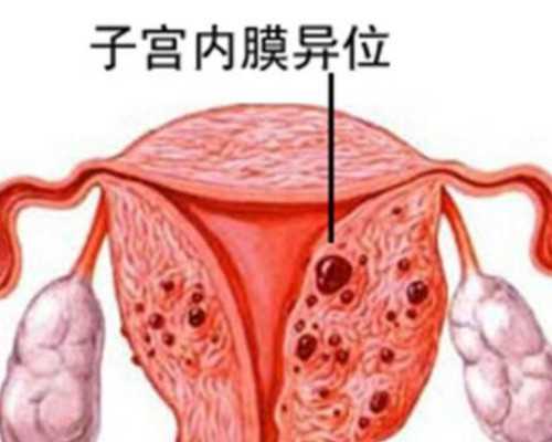 国内有正规的代孕机,男方先天性输精管缺如可以通过人工授精*育吗